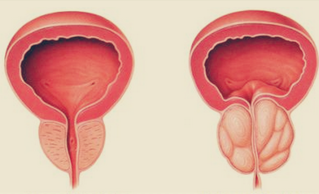 Buvijonning shirali jinsiy aloqasi