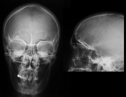 Ajoyib onalar bilan jinsiy aloqa