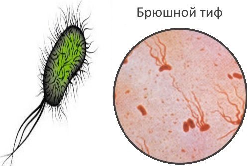 salmonella bakteriyasi