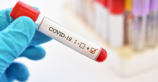 covid-19 virusi